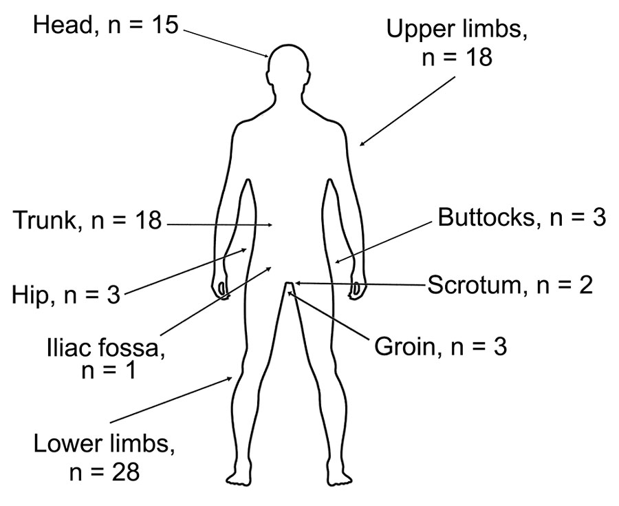 Numbers and body locations of tick bites and inoculation eschars in patients with Rickettsia sibirica mongolitimonae infections during 2007–2024, Spain, and from published literature. Patients manifested single or multiple eschars. Cases were diagnosed at the Center for Rickettsiosis and Arthropod-Borne Diseases, La Rioja, Spain and/or identified in PubMed. 