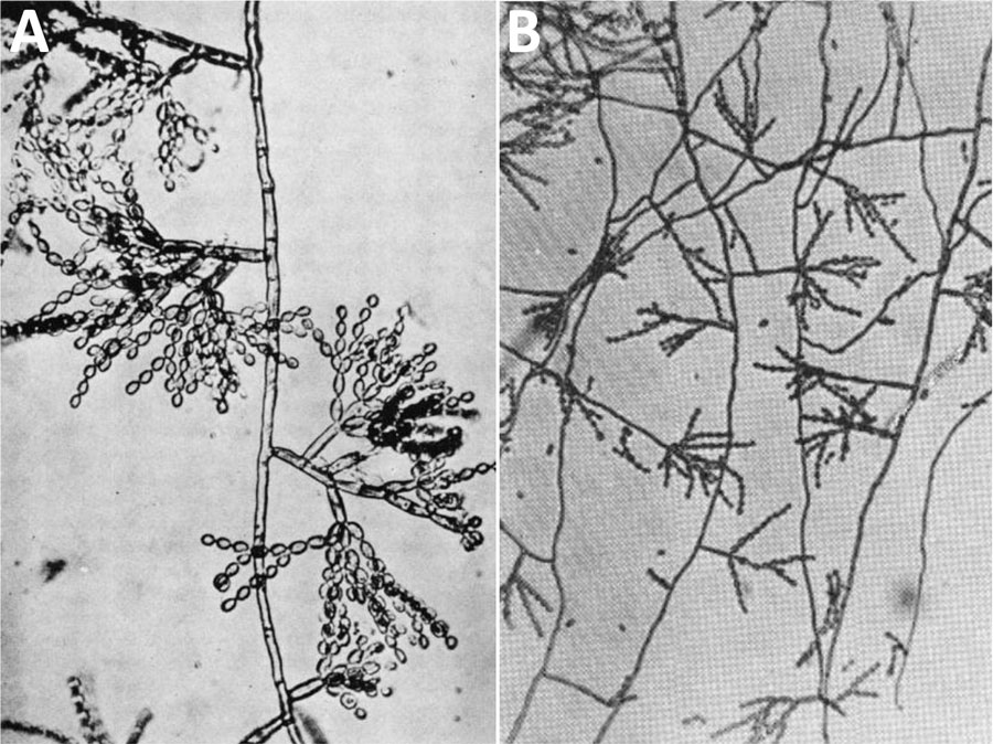 Images from early records of Cladosporium carrionii. A) Fonsecaea pedrosoi var. cladosporium by F.W. Simson in 1946. B) Cladosporium carrionii n. sp. by A. Trejos in 1954.