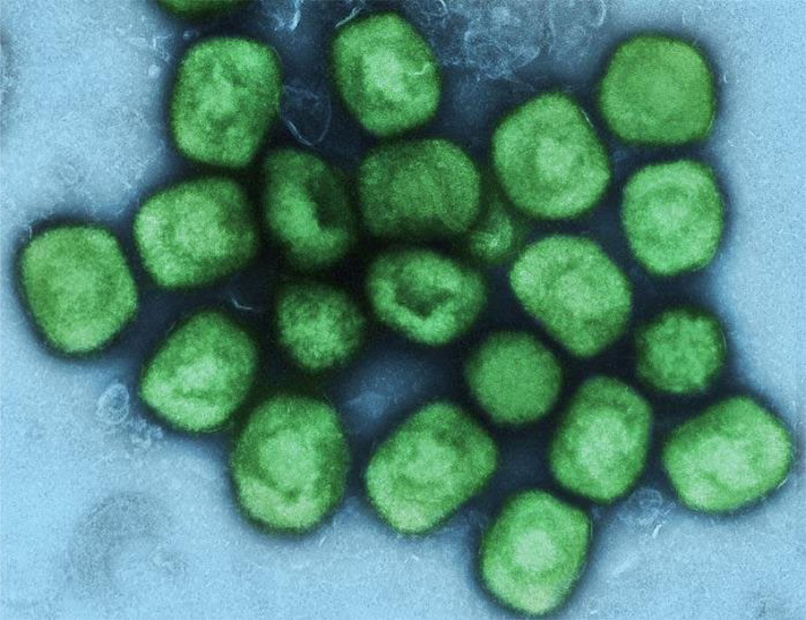 Colorized transmission electron microscopic image of monkeypox virus particles (green) that were cultivated and purified from cell culture. The image was captured at the National Institute of Allergy and Infectious Diseases Integrated Research Facility, Fort Detrick, Maryland, USA.