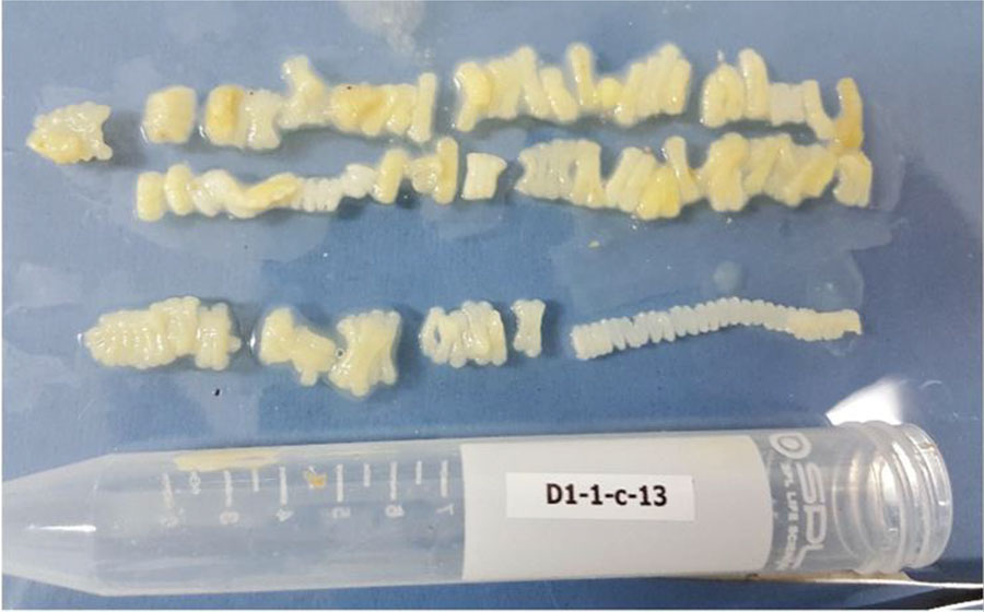 Proglottids of Taenia solium collected from a patient in Dili, Timor-Leste, in case study of molecular confirmation of taeniasis in a child. We collected the expelled worm segments from a 10-year-old girl on the same day she was treated with 10 mg/kg praziquantel.