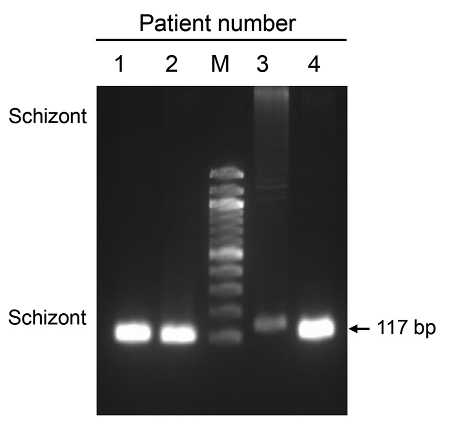 Identification of Plasmodium vivax infections in blood samples from malaria patients, Florida, USA, May–July 2023. Image shows 117-bp PCR products amplified from blood samples from 4 patients by using P. vivax–specific primers targeting the 18S rRNA gene. M, DNA ladder.