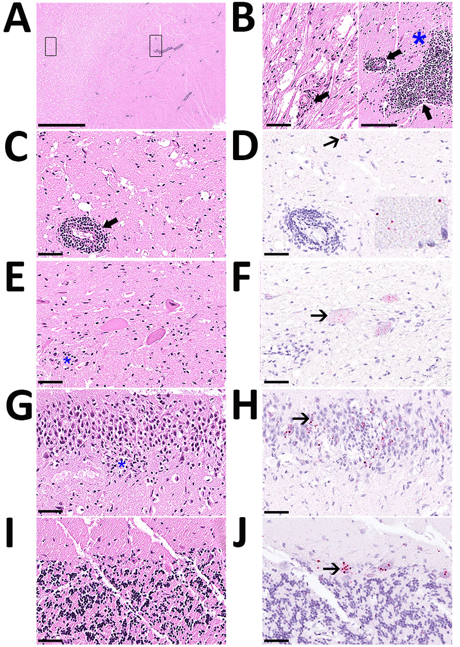 Histology of brain and spinal cord used to detect rustrela virus (RusV) in wild mountain lion (Puma concolor) with staggering disease, Colorado, USA. RusV RNA was detected by RNAscope Reagent Kit-Red (Advanced Cell Diagnostics/bio-techne, https://www.bio-techne.com) in situ hybridization. All sections demonstrate artifactual clefting of the neuropil due to freezing of the tissue postmortem. A) Cerebral cortex with perivascular cuffing and mild gliosis of the white and gray matter; boxes indicate detailed areas in panel B. Scale bar indicates 2.5 mm. B) The white matter (left panel) is minimally affected by perivascular lymphohistiocytic infiltrates (bold arrow), compared with the gray matter (right panel), also showing gliosis (asterisk). Scale bar indicates 100 µm. C) Midbrain affected by perivascular cuffing. Scale bar indicates 50 µm. D) Midbrain showing chromogenic labeling (fast red) of RusV in neuronal cell bodies (slender arrow) and in the neuropil (inlay). Scale bar indicates 50 µm. E) Spinal cord with 3 motor neurons showing variable degree of degeneration/necrosis and also gliosis (asterisk). Scale bar indicates 50 µm. F) Spinal cord with affected motor neurons with RusV RNA detection. Scale bar indicates 50 µm. G) Hippocampus exhibiting irregular architecture of the granule layer and gliosis (asterisk). Scale bar indicates 50 µm. H) Hippocampus with numerous RusV RNA signals in neurons of the granule cell layer in areas with or without irregular architecture. Scale bar indicates 50 µm. I) Cerebellum, no indication for inflammation or any degenerative process. Scale bar indicates 50 µm. J) Cerebellum with abundant RusV RNA labeling in Purkinje cells. Scale bar indicates 50 µm. A–C, E, G, I) Hematoxylin-eosin staining; D, F, H, I) RNAscope in situ hybridization with probes against the nonstructural protein–coding region of RusV, counterstained with Mayer’s hematoxylin.