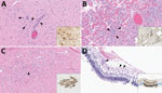 Lesions in cat tissues in study of highly pathogenic avian influenza A(H5N1) clade 2.3.4.4b virus infection in domestic dairy cattle and cats, United States, 2024. Tissue sections were stained with hematoxylin and eosin; insets show brown staining of avian influenza A viruses via immunohistochemistry by using the chromogen 3,3′-diaminobenzidine tetrahydrochloride. Original magnification ×200 for all images and insets. A) Section from cerebral tissue. Arrowheads show perivascular lymphocytic encephalitis, gliosis, and neuronal necrosis. Inset shows neurons. B) Section of lung tissue showing lymphocytic and fibrinous interstitial pneumonia with septal necrosis and alveolar edema; arrowheads indicate lymphocytes. Inset shows bronchiolar epithelium, necrotic cells, and intraseptal mononuclear cells. C) Section of heart tissue. Arrowhead shows interstitial lymphocytic myocarditis and focal peracute myocardial coagulative necrosis. Inset shows cardiomyocytes. D) Section of retinal tissue. Arrowheads show perivascular lymphocytic retinitis with segmental neuronal loss and rarefaction in the ganglion cell layer. Asterisks indicate attenuation of the inner plexiform and nuclear layers with artifactual retinal detachment. Insets shows all layers of the retina segmentally within affected areas have strong cytoplasmic and nuclear immunoreactivity to influenza A virus. 