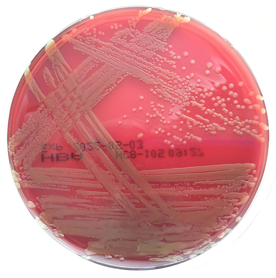 Results of blood culture for patient with Pantoea stewartii subspecies indologenes infection, Queensland, Australia. Yellow pigmented colonies grew on horse blood agar on day 1 of subculture after incubation in 5% CO2 at 35°C. VITEK MS matrix-assisted laser desorption/ionization time-of-flight mass spectrometry (bioMérieux, https://www.biomerieux.com) identified the pathogen as Pantoea ananatis with 99.9% probability, but further analyses revealed that the pathogen was most closely related to P. stewartii subsp. indologenes.