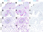 Respiratory tract tissues from a US dairy cow infected with highly pathogenic avian influenza A(H5N1) virus, showing IAV-Np (teal chromogen), individually duplexed with MAL-I (magenta chromogen), MAL-II (magenta chromogen), and SNA (magenta chromogen) using chromogenic staining. Representative images are shown for IAV-Np/MAL-I (A, D, G, J), IAV-Np/MAL-II (B, E, H, K), and IAV-Np/SNA (C, F, I, L) are shown. No IAV-Np was observed in the unaffected respiratory tissue sections. Intense granular to punctate labeling for MAL-I (A) and MAL-II (B) were observed within goblet cells (arrowheads), along the apical ciliated margin (arrows), and glands of the trachea. SNA labeling (C) was confined to intraepithelial round cells (arrows), endothelium, and glands of the trachea. Similar labeling for MAL-I (D) and MALII (E) was observed within the bronchial lumen within goblet cells (arrowheads) and along the apical cell margin (arrows). SNA (F) labeling was only observed in rare goblet cells (arrowheads) and lamina proprial round cells (arrows) in the bronchus. Bronchioles had diffuse, fine, fibrillary to apical membranous labeling (arrows) MAL-I (G) and MALII (H). No substantial labeling was detected within the mucosal epithelial cells of bronchioles with SNA (I). Diffuse, fine, apical membranous labeling of pneumocytes lining alveoli was observed with MAL-I (J) and MAL-II (K) (arrows). SNA (L) labeling within the alveolar portions of the lung was confined to endothelium and interstitial round cells. Scale bars indicate 200 μm. IAV-Np, influenza A virus nucleoprotein; MAL, Maackia amurensis lectin; SNA, Sambucus nigra lectin. 