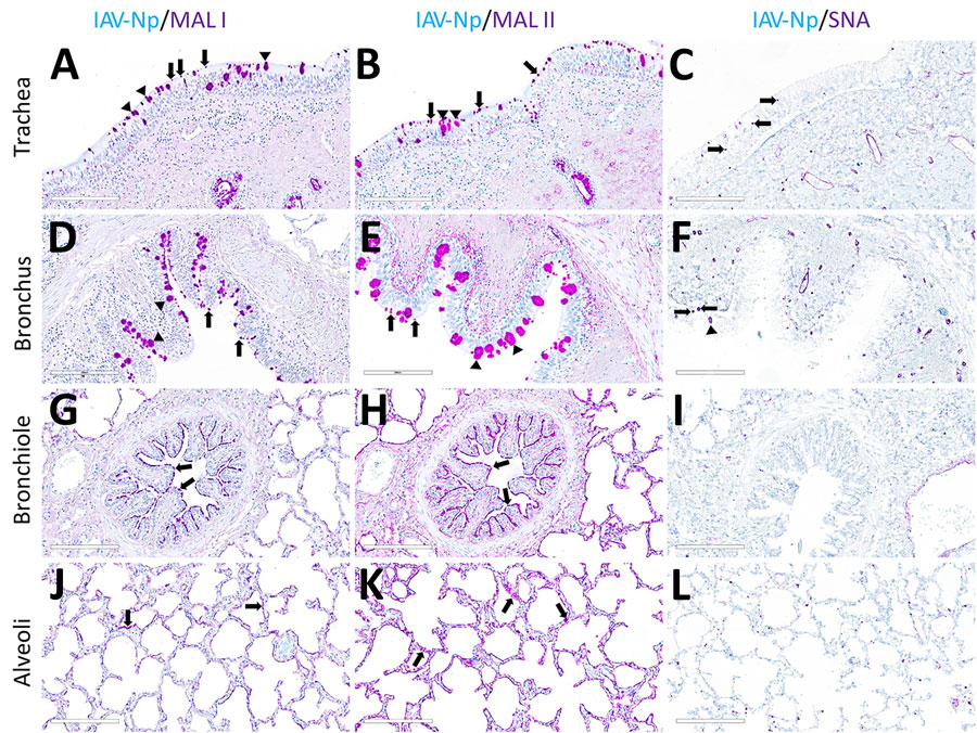 Respiratory tract tissues from a US dairy cow infected with highly pathogenic avian influenza A(H5N1) virus, showing IAV-Np (teal chromogen), individually duplexed with MAL-I (magenta chromogen), MAL-II (magenta chromogen), and SNA (magenta chromogen) using chromogenic staining. Representative images are shown for IAV-Np/MAL-I (A, D, G, J), IAV-Np/MAL-II (B, E, H, K), and IAV-Np/SNA (C, F, I, L) are shown. No IAV-Np was observed in the unaffected respiratory tissue sections. Intense granular to punctate labeling for MAL-I (A) and MAL-II (B) were observed within goblet cells (arrowheads), along the apical ciliated margin (arrows), and glands of the trachea. SNA labeling (C) was confined to intraepithelial round cells (arrows), endothelium, and glands of the trachea. Similar labeling for MAL-I (D) and MALII (E) was observed within the bronchial lumen within goblet cells (arrowheads) and along the apical cell margin (arrows). SNA (F) labeling was only observed in rare goblet cells (arrowheads) and lamina proprial round cells (arrows) in the bronchus. Bronchioles had diffuse, fine, fibrillary to apical membranous labeling (arrows) MAL-I (G) and MALII (H). No substantial labeling was detected within the mucosal epithelial cells of bronchioles with SNA (I). Diffuse, fine, apical membranous labeling of pneumocytes lining alveoli was observed with MAL-I (J) and MAL-II (K) (arrows). SNA (L) labeling within the alveolar portions of the lung was confined to endothelium and interstitial round cells. Scale bars indicate 200 μm. IAV-Np, influenza A virus nucleoprotein; MAL, Maackia amurensis lectin; SNA, Sambucus nigra lectin. 