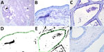 Results of staining showing wide expression of the human receptor for influenza A virus (designated SNA) in the bovine mammary gland. A) An example of the SNA staining of a mammary gland from a cow in late lactation. Arrowhead indicates expression of the human receptor in the active alveoli. Asterisks indicate less staining in the less active alveoli. Original magnification ×10. B, C) SNA staining of a duct (B) and (C) an alveolus in a 7-year-old cow. Original magnification ×60. D, E) Positive staining obtained from the image analysis. Green line shows the region of interest. Original magnification ×60. F) A neuraminidase pretreatment negative control showed markedly reduced staining of the SNA lectin. Original magnification ×60. The staining was visualized using Vector Blue (Vector Laboratories, https://vectorlabs.com).