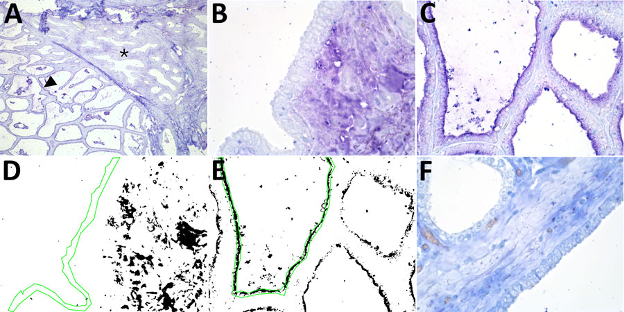 Results of staining showing wide expression of the duck receptor for influenza A virus (designated MAA-II) in the alveoli of the bovine mammary gland. A) An example of the MAA-II staining of a mammary gland from a cow in late lactation. Arrowhead indicates expression of the duck receptor in active alveoli. Asterisks indicate less staining in the less active alveoli. Original magnification ×10. B, C) MAA-II staining of a duct (B) and an alveolus (C) in a 3-year-old cow. Original magnification ×60. D, E) Positive staining obtained from the image analysis. Green line shows the region of interest. Original magnification ×60. F) A neuraminidase pretreatment negative control showed markedly reduced staining of the MAA-II lectin in the alveolus but some nonspecific staining in the duct epithelium. The staining was visualized using Vector Blue (Vector Laboratories, https://vectorlabs.com). Original magnification ×60.