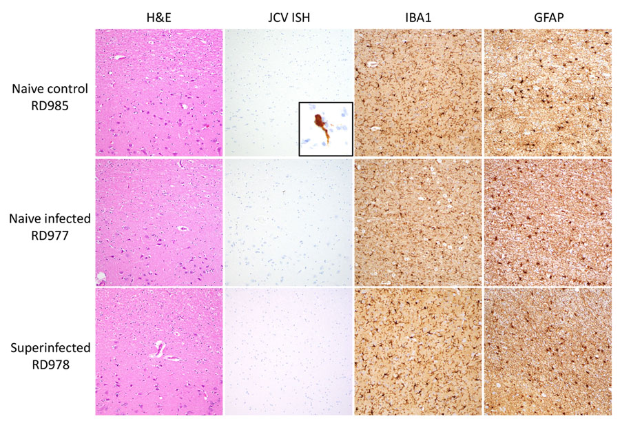 Histopathology of samples from reindeer experimentally infected with JCV. Representative brain sections from naive control (RD985), naive infected (RD977), and superinfected (RD978) animals shows H&E-stained sections of cerebral cortex and subcortical white matter with minimal diagnostic abnormalities, negative JCV RNA ISH staining, scattered IBA1-positive microglia/macrophages, and mild-to-moderate astrocytosis highlighted by GFAP immunohistochemistry. JCV ISH naive control inset panel demonstrates positive cytoplasmic staining in a cortical neuron from a positive control case of fatal JCV encephalitis in a human. All images taken with 20× objective with exception of the JCV ISH inset, taken with 60× objective. GFAP, glial fibrillary acidic protein; H&E, hematoxylin and eosin; IBA, allograft inflammatory factor 1; ISH, in situ hybridization; JCV, Jamestown Canyon virus.