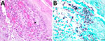 Skin lesions of sporotrichosis in a cat, Oklahoma, USA. A) Suppurative dermatitis with numerous 4-to 10-μm diameter intralesional yeasts (black arrowhead). Hematoxylin and eosin stain; scale bar indicates 50 μm. B) Occasional cigar-shaped morphology of Sporothrix schenckii (magenta arrow). Grocott methenamine silver stain; scale bar indicates 20 μm.