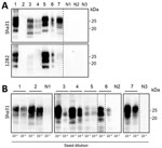 Western blots and protein misfolding cyclic amplification (PMCA; using bank vole substrate) of brain isolates of animals analyzed in a study of prions in muscles of cervids with chronic wasting disease, Norway. A) Western blot analyses of proteinase K–digested brain samples demonstrate the different PrPSc (misfolded forms of the prion protein) molecular profiles of the chronic wasting disease strains present in reindeer, moose (affected by different strains: N terminally truncated PrPSc in moose A and B, and not N terminally truncated PrPSc in moose C and D), and a red deer. The PrPres (protease-resistant prion) signal visualized by Sha31 antibody demonstrates the typical electrophoretic migration of PrPSc protein bands, and the 12B2 antibody demonstrates the different cleavages at the N terminal of the PrP (major prion) protein, which are characteristic for the different strains. B) PMCA amplification of the same brain samples (10−4 and 10−8 dilutions as indicated) using bank vole brain substrate. After 4 rounds of PMCA, amplicons were treated with proteinase K, and PrPres was visualized by Western blot using Sha31 antibody. Our PMCA protocol efficiently amplified prions from all chronic wasting disease–affected samples, regardless of the different strains. No PrPSc amplification was observed in the brain of healthy negative control reindeer (N1), moose (N2), and red deer (N3). Lane designations: 1, reindeer A; 2, reindeer B; 3, moose A; 4, moose B; 5, moose C; 6, moose D; 7, red deer. In panel A, tissue equivalents of 10 mg were loaded for each lane, except lanes 3 (tissue equivalents: 2 mg) and 5 (tissue equivalents: 1 mg). The same quantities of PrPres were loaded for both antibody visualizations. In panel B, equivalent sample volumes were loaded for all lanes. Numbers at the right indicate the molecular weight marker. Dashed lines between images depict membrane splicing.