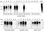 Protein misfolding cyclic amplification (PMCA) amplification of PrPSc (misfolded forms of the prion protein) in the lymphoreticular system and peripheral nerves of chronic wasting disease–affected animals from a study of prions in muscles of cervids with chronic wasting disease, Norway. We subjected lymph nodes and nerves collected from chronic wasting disease–affected cervids in Norway to serial PMCA before proteinase K digestion and Western blot analysis using Sha31 antibody. Example Western blots of samples from 1 representative animal of the different species and strains are shown; a more comprehensive result of all analyzed samples is summarized in Table 2. Lane designations: 1, reindeer A; 3, moose A; 5, moose C; 7, red deer. N lanes show lymph node from healthy, negative reindeer (N1), moose (N2), and red deer (N3). Dashed lines between images depict membrane splicing. NBH, proteinase K–undigested bank vole brain homogenate used as electrophoretic migration marker of normal prion protein; par, parotid node; RPLN, retropharyngeal node; axil, axillary node; pre, prescapular node; pop, popliteal node; U, unseeded reaction included as a specificity control of PMCA reaction. 