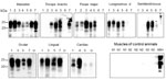 Detection of PrPSc (misfolded forms of the prion protein) amplification in muscle tissues of chronic wasting disease–affected cervids by protein misfolding cyclic amplification (PMCA) from a study of prions in muscles of cervids with chronic wasting disease, Norway. Muscle samples (10% homogenates) were subjected to 6 rounds of PMCA using bank vole brain homogenate substrate. PMCA products were treated with proteinase K before being analyzed by Western blot using Sha31 antibody to identify presence of PrPSc. Results demonstrate efficient amplification of PrPSc in skeletal and cardiac muscles of chronic wasting disease–affected reindeer, moose, and a red deer. No PrPSc was amplified in negative control samples. Lane designations: 1, reindeer A; 2, reindeer B; 3, moose A; 4, moose B; 5, moose C; 6, moose D; 7, red deer. Numbers at left indicate the molecular weight marker. Asterisks indicate unspecific signals. NBH, proteinase K–undigested bank vole brain homogenate used as electrophoretic migration marker of normal prion protein (PrPC); U, unseeded reaction included as a specificity control of PMCA reaction.