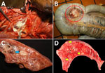 Postmortem photographs of an American quarter horse in study of multisystemic disease and septicemia caused by presumptive Burkholderia pseudomallei, Florida, USA. A) The submandibular lymph node was enlarged up to 20 cm in diameter and almost completely effaced by purulent material that extended into the retropharyngeal space and drains near the mandibular ramus. B) Cecal lymph nodes were diffusely enlarged up to 6 cm in diameter and filled with purulent material (red circle). C) The lung was diffusely firm with rib impressions and multifocal 5 × 5-mm to 1 × 2-cm abscesses (blue arrow). D) The liver contained multifocal random 1 × 1-cm pale tan foci scattered throughout the hepatic parenchyma (yellow arrows). 
