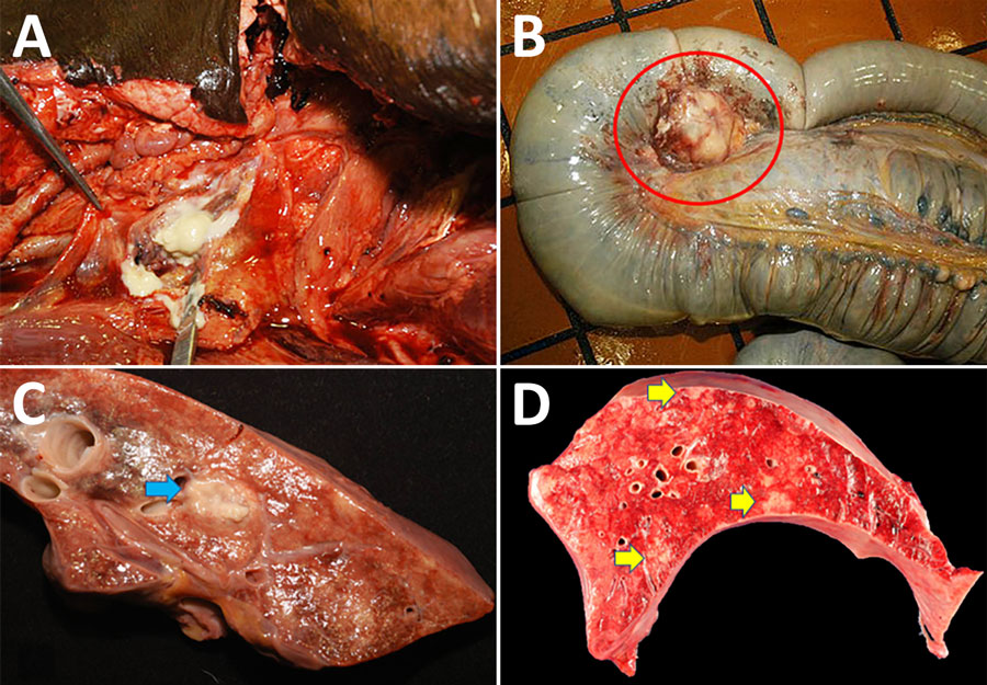 Postmortem photographs of an American quarter horse in study of multisystemic disease and septicemia caused by presumptive Burkholderia pseudomallei, Florida, USA. A) The submandibular lymph node was enlarged up to 20 cm in diameter and almost completely effaced by purulent material that extended into the retropharyngeal space and drains near the mandibular ramus. B) Cecal lymph nodes were diffusely enlarged up to 6 cm in diameter and filled with purulent material (red circle). C) The lung was diffusely firm with rib impressions and multifocal 5 × 5-mm to 1 × 2-cm abscesses (blue arrow). D) The liver contained multifocal random 1 × 1-cm pale tan foci scattered throughout the hepatic parenchyma (yellow arrows). 