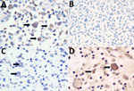 Immunohistochemical examination of tissues from American quarter horse with multisystemic disease and septicemia caused by presumptive Burkholderia pseudomallei, Florida, USA. Photomicrographs show immunohistochemistry for monoclonal antibodies 3A2 (A), 4C7 (B), 4C4 (C), and 5B4 (D) of the submandibular lymph node. A) Intra-phagocytic bacilli demonstrated strong immunoreactivity to 3A2 monoclonal antibody to B. pseudomallei lipopolysaccharides (LPS) O-Ag B/B2 (black arrows). Original magnification ×100. B) Intra-phagocytic bacilli were diffusely immunonegative for 4C7 monoclonal antibody to B. pseudomallei LPS O-ag serotype A. Original magnification ×40. C) Intra-phagocytic bacilli demonstrated weak multifocal immunoreactivity to 4C4 monoclonal antibody to B. pseudomallei capsular polysaccharides (black arrows). Original magnification ×100. D) Intra-phagocytic bacilli demonstrated strong immunoreactivity to 5B4 monoclonal antibody to B. pseudomallei LPS O-Ag B/B2 (black arrows). Original magnification ×100. Bacilli were immunonegative to 3D11 (not shown) monoclonal antibody to Bm LPS O-Ag.