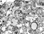 Transmission electron microscopy of formalin-fixed paraffin embedded lung section of case 1 in an investigation of novel mastadenovirus infection causing pneumonia in imported black-and-white colobuses (Colobus guereza), Thailand. A) Destructed bronchial epithelial cell showing degenerated plasma membrane and a large cytoplasmic vacuole containing electron-dense particles (inset area of interest at 100× magnification). N indicates nuclear membrane. Scale bar indicates 200 nm. B) Random viral particles distributed in cytosol; viral particles are seen near ruptured nuclear (N) membrane (inset area of interest at 100× magnification). Scale bar indicates 100 nm. C) Mature icosahedral electron-dense viral particles in the cytosol. Black arrows indicate plasma membrane. Scale bar indicates 100 nm. D) A vacuole containing electron-lucent particle and a free-living electron-dense particle in the cytosol. Scale bar indicates 100 nm.