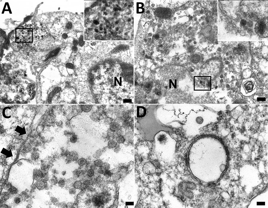 Transmission electron microscopy of formalin-fixed paraffin embedded lung section of case 1 in an investigation of novel mastadenovirus infection causing pneumonia in imported black-and-white colobuses (Colobus guereza), Thailand. A) Destructed bronchial epithelial cell showing degenerated plasma membrane and a large cytoplasmic vacuole containing electron-dense particles (inset area of interest at 100× magnification). N indicates nuclear membrane. Scale bar indicates 200 nm. B) Random viral particles distributed in cytosol; viral particles are seen near ruptured nuclear (N) membrane (inset area of interest at 100× magnification). Scale bar indicates 100 nm. C) Mature icosahedral electron-dense viral particles in the cytosol. Black arrows indicate plasma membrane. Scale bar indicates 100 nm. D) A vacuole containing electron-lucent particle and a free-living electron-dense particle in the cytosol. Scale bar indicates 100 nm.