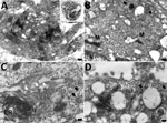 Transmission electron microscopy of Vero cell of case 1 in an investigation of novel mastadenovirus infection causing pneumonia in imported black-and-white colobuses (Colobus guereza), Thailand. A) Vero cells 1 day postinfection; B–C) Vero cells at 5 days postinfection A) Cytoplasmic vacuolated Vero cell contains numerous electron-dense particles packed within a destructed nucleus. Inset indicates the overall cellular morphology of an infected cell, and asterisk  within indicates the area of higher magnification. Scale bar indicates 400 nm. B) Viral particles arranged within the cytosol as freely-distributed and clustered patterns (black arrows). M indicates mitochondria; N indicates nucleus. Scale bar indicates 300 nm. C) Electron-lucent viral particles within nuclear membrane and fused nuclear membrane (black arrows); electron-dense particles (white arrows) are seen within the endoplasmic reticulum (ER). Scale bar indicates 100 nm. D) A viral particle fused with plasma membrane (black arrow) and the budding virions (white arrow) in extracellular space. Scale bar indicates 100 nm.