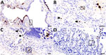 Adenoviral immunohistochemically stained lung and intestine sections from case 1 in an investigation novel mastadenovirus infection causing pneumonia in imported black-and-white colobuses (Colobus guereza), Thailand. A–C) Lung sections; D) intestine section. A) Nuclear labeling of adenoviral antigen in the bronchial epithelial lining; inset shows area of interest at 400× magnification. B) Adenoviral antigen is localized in the nuclei of pulmonary epithelial cells (arrows); inset shows endothelial-like cells from area of interest at 400× magnification. C) Infiltrated inflammatory cells and bronchial glands of the trachea (arrows); inset shows inflammatory cells at 400× magnification. D) Adenoviral antigen detected in rare, single inflammatory cells infiltrating the intestinal villi; inset shows area of interest at 400× magnification. Scale bars indicate 50 µm.