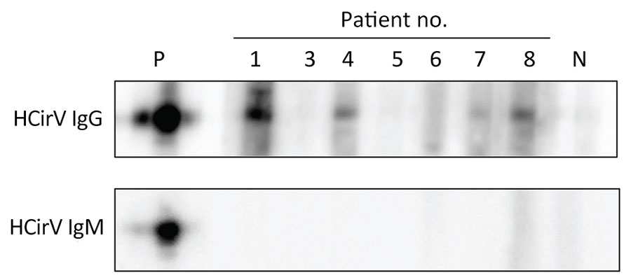 IgM and IgG immunoblots of 7 patients for whom sufficient serum was available from study of HCirV in patients with hepatitis, Hong Kong. P indicates positive control, mouse polyclonal serum raised against HCirV cap protein. N indicates HCirV PCR-negative human donor sample. HCirV, human circovirus.