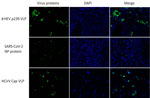 Cell-binding assay showing binding of HCirV VLPs to PLC/PRF/5 cells in study of HCirV in patients with hepatitis. HEV VLPs (bHEV p239) is included as a positive control; SARS-CoV-2 NP protein is included as a negative control. Nuclei are counterstained with DAPI. Cap, capsid; HCirV, human circovirus; HEV, hepatitis E virus; NP, nucleoprotein; VLP, virus-like particle.