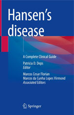 Hansen’s Disease: A Complete Clinical Guide