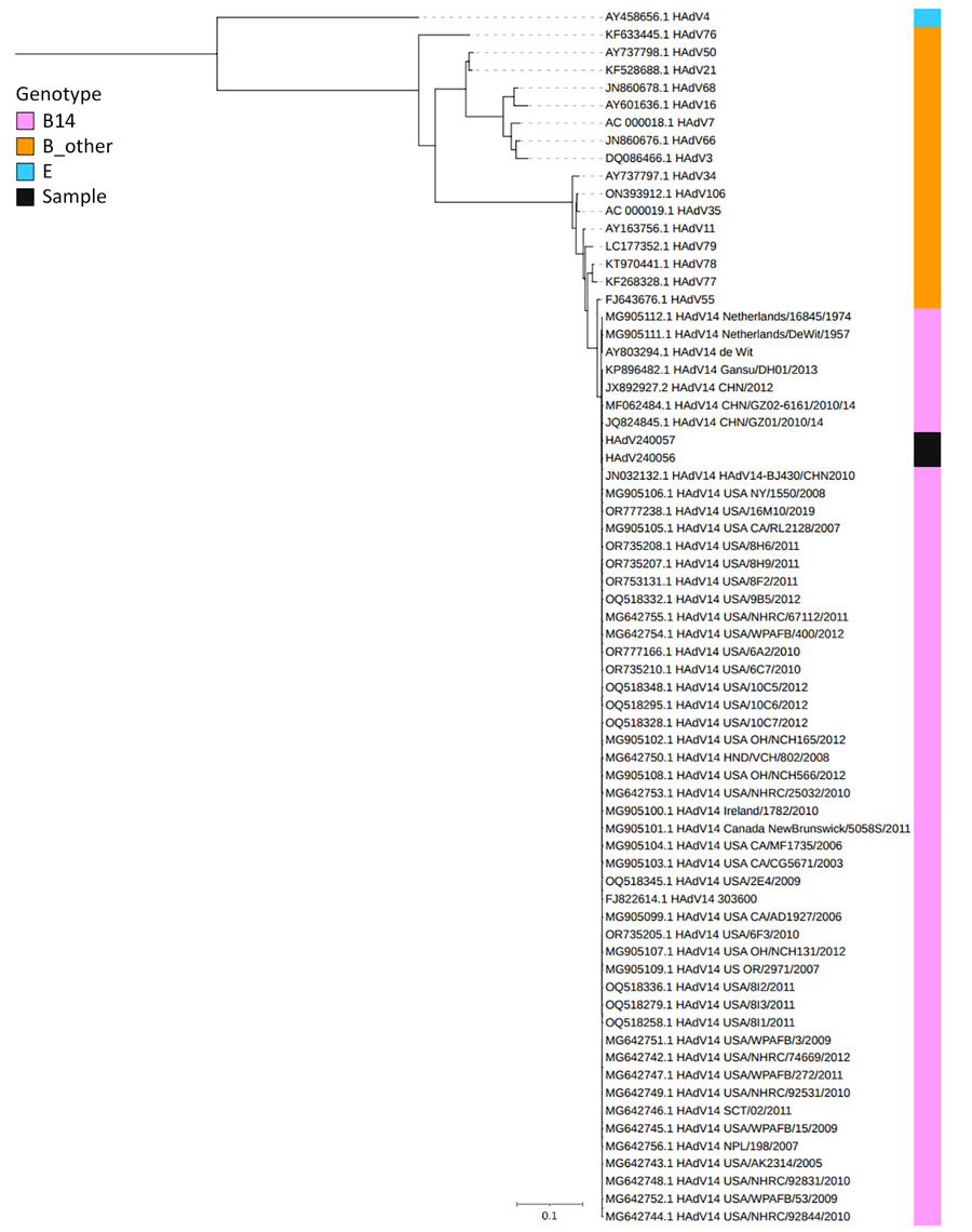 Phylogenetic analysis of HAdV complete sequences from patient isolates in study of acute encephalopathy associated with human adenovirus type 14 infection in 7-year-old girl, Japan, and reference sequences. The most recent reference strain was from the United States in 2019. The tree was created by IQ-TREE (9) using the maximum composite-likelihood methods with 1,000 bootstrap replicates. GenBank accession numbers are provided for reference sequences. Scale bar indicates number of substitutions per site.