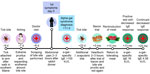 Timeline of symptom onset in a patient with alpha-gal syndrome after Ixodes scapularis tick bite, Maine, USA, 2022.