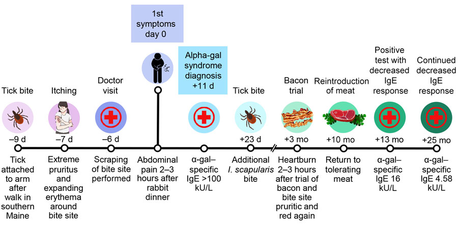 Timeline of symptom onset in a patient with alpha-gal syndrome after Ixodes scapularis tick bite, Maine, USA, 2022.