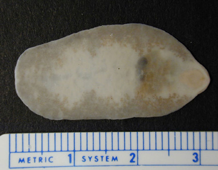 Adult Fasciolopsis buski fluke. Source: DPDx (https://www.cdc.gov/dpdx).