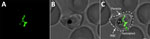 Visualization of the apicoplast organelle inside a malaria parasite. Microscopy image of a Plasmodium falciparum transgenic parasite expressing a green fluorescent protein (GFP) fused to a transit peptide, which marks the apicoplast. A) Apicoplast visualized through targeted GFP; B) bright field showing P. falciparum parasite in human RBC; C) merged image of GFP and bright field. Outer dashed line depicts the membrane of the iRBC. Inner dashed line depicts the cell membrane of the intraerythrocytic parasite. The intricate green structure is the apicoplast in its elongated phase during the last hours of the intraerythrocytic cell cycle. FV appears as a black sac-like structure. Image taken using a confocal microscope; scale bar indicates 1.25 µm. FV, food vacuole; iRBC, infected red blood cell.