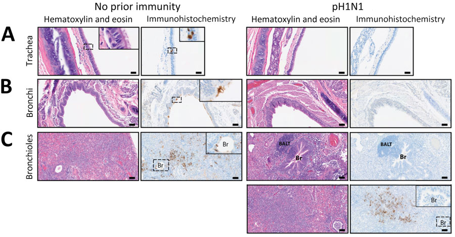 Hematoxylin and eosin stained and immunohistochemistry tissue samples from a study of influenza A(H5N1) immune response among ferrets with pH1N1 immunity. A) Tracheal tissue. Scale bars indicate 20 mm; inset shows magnification ×400.; B) Bronchial tissue. Scale bars indicate 50 mm; inset shows magnification ×200. C) Bronchiole tissue. Scale bars indicate 50 mm; inset shows magnification ×200. Ferrets with no prior immunity (left panels) or existing influenza A(H1N1)pdm09 immunity (right panels) were infected with 104 50% tissue culture infectious dose of H5N1 strain A/dairy cattle/Texas/24-008749-001/2024(H5N1) and humanely euthanized 3 days postinfection. Images show hematoxylin and eosin stained (purple) tissues and immunohistochemistry of influenza A nucleoprotein (blue). Dotted squares indicate areas that are magnified within the inset panel in tissues from ferrets with no prior immunity versus normal secondary germinal center in pH1N1-immumne ferret. BALT, bronchus-associated lymphoid tissue; Br, bronchiole; pH1N1, influenza A(H1N1)pdm09.