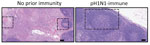 Hematoxylin and eosin stained and immunohistochemistry lymph node samples from a study of influenza A(H5N1) immune response among ferrets with pH1N1 immunity. Ferrets with no prior immunity (left panel) or pH1N1 (right panel) were infected with 104 50% tissue culture infectious dose of H5N1 strain A/dairy cattle/Texas/24-008749-001/2024(H5N1) and humanely euthanized 3 days postinfection. Images show hematoxylin and eosin stained (purple) tissues and immunohistochemistry of influenza A nucleoprotein (blue). Dotted squares indicate areas that are with cortical lymphoid necrosis and depletion in tissues from ferrets with no prior immunity versus normal secondary germinal center in pH1N1-immumne ferret. Scale bars indicate 100 mm. pH1N1, influenza A(H1N1)pdm09.