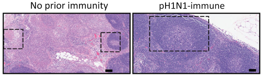 Hematoxylin and eosin stained and immunohistochemistry lymph node samples from a study of influenza A(H5N1) immune response among ferrets with pH1N1 immunity. Ferrets with no prior immunity (left panel) or pH1N1 (right panel) were infected with 104 50% tissue culture infectious dose of H5N1 strain A/dairy cattle/Texas/24-008749-001/2024(H5N1) and humanely euthanized 3 days postinfection. Images show hematoxylin and eosin stained (purple) tissues and immunohistochemistry of influenza A nucleoprotein (blue). Dotted squares indicate areas that are with cortical lymphoid necrosis and depletion in tissues from ferrets with no prior immunity versus normal secondary germinal center in pH1N1-immumne ferret. Scale bars indicate 100 mm. pH1N1, influenza A(H1N1)pdm09.