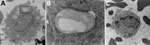 Transmission electron microscopy presentation of whole blood indicating foamy macrophages from infected mice in study of Peromyscus species deer mice as rodent model of acute leptospirosis. A) Image of foamy macrophages with membrane-bound lipid droplet in black box; original magnification ×6,800. B) Close-up of membrane-bound lipid droplet from box in panel A (original magnification ×49,000). C) Noninfected control monocyte (original magnification ×6,800).