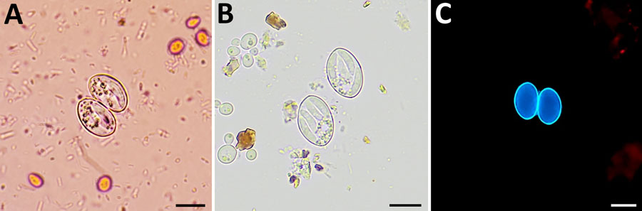 Oocysts of Sarcocystis spp. from patients with human intestinal sarcocystosis, France, 2021–2024. A) Concentrated stool smear stained using the merthiolate-iodine-formaldehyde method. Sporulated oocysts are colorless and contain 2 elongated sporocysts. The oocyst wall is thin and often invisible in wet mount. B) Wet mount. Each sporocyst contains 4 banana-shaped sporozoites and a granular sporocyst residuum, which may be compact or dispersed. The 4 sporozoites are rarely seen in a single plane of focus. C) Fresh homogenized stool smear under fluorescent microscopy. Individual sporocysts are autofluorescents and will appear blue with an excitation filter of 330–365 nm. Scale bars indicate 10 µm.