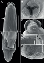 Scanning electron micrographs of female Baylisascaris procyonis roundworm detected in common raccoon (Procyon lotor), Mexico. A) Anterior end of worm body. Arrow indicates the excretory pore. Scale bar indicates 400 μm. B) Cephalic end, apical view of worm. Lowercase letters indicate dorsal (d) and ventral (v) lips, each having 1 large double papillae instead of a dorsal lip with 2 large double papillae, as reported previously (4). Small and large arrows indicate the double papillae. Scale bar indicates 100 μm. C) Cephalic end of worm. Small and large arrows indicate the double papillae. Scale bar indicates 100 μm. D) Magnified image of labial denticles. Scale bar indicates 5 μm. E) Magnified image of the excretory pore. Scale bar indicates 10 μm. F) Posterior end of the worm body. Scale bar indicates 300 μm. G) Magnified image of the tail tip. Scale bar indicates 10 μm.