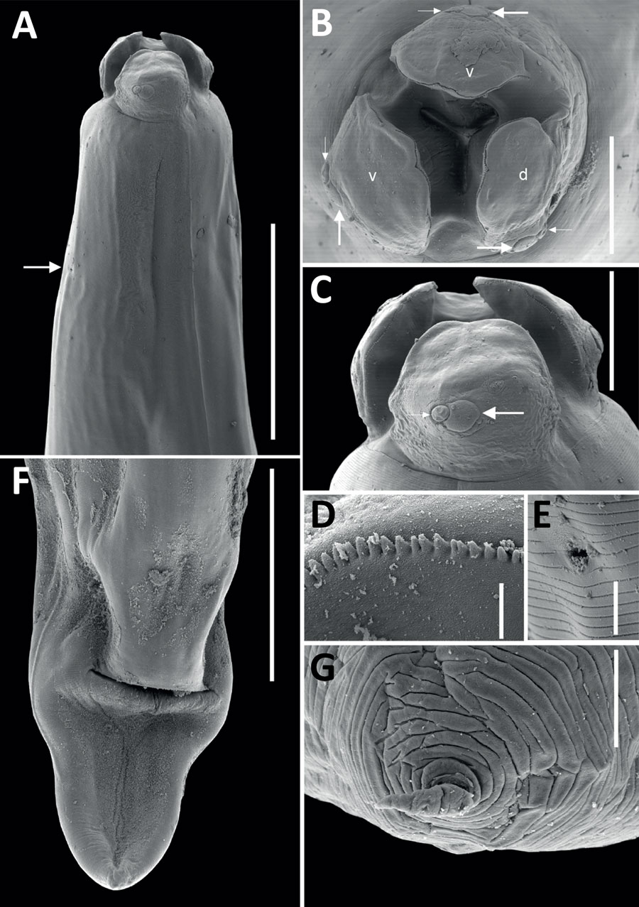 Scanning electron micrographs of female Baylisascaris procyonis roundworm detected in common raccoon (Procyon lotor), Mexico. A) Anterior end of worm body. Arrow indicates the excretory pore. Scale bar indicates 400 μm. B) Cephalic end, apical view of worm. Lowercase letters indicate dorsal (d) and ventral (v) lips, each having 1 large double papillae instead of a dorsal lip with 2 large double papillae, as reported previously (4). Small and large arrows indicate the double papillae. Scale bar indicates 100 μm. C) Cephalic end of worm. Small and large arrows indicate the double papillae. Scale bar indicates 100 μm. D) Magnified image of labial denticles. Scale bar indicates 5 μm. E) Magnified image of the excretory pore. Scale bar indicates 10 μm. F) Posterior end of the worm body. Scale bar indicates 300 μm. G) Magnified image of the tail tip. Scale bar indicates 10 μm.