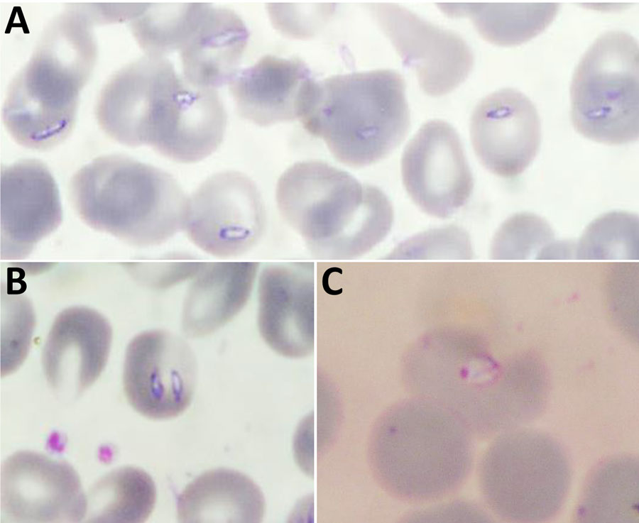 Blood smears showing Babesia spp. trophozoites in study of 3 cases of human babesiosis, Italy, 2017–2020. Smears were stained with Giemsa stain. A, B) B. canis canis identified in patient 1. Original magnification ×630. C) B. vulpes identified in patient 3. Original magnification ×1,000 (oil immersion).
