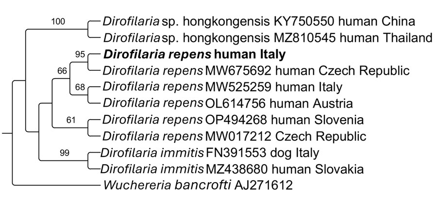 Phylogeny of Dirofilaria repens based on cox1 gene sequences in study of rapid subcutaneous migration of D. repens nematode in facial tissue, Italy. The sequence of this study is shown in bold. Wuchereria bancrofti was used as outgroup. Bootstrap confidence values (1,000 replicates) are shown at the nodes only for values >60%.