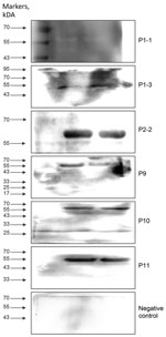 Western blot analysis of the target protein (55-kDa) expression in the serum samples from 5 patients with suspected protozoan infection in study of piroplasmorida in humans, southwest China, May 2017–June 2020.