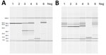 Genotyping study of Plasmodium falciparum isolated from 2 patients involved in nosocomial transmission of P. falciparum malaria, Spain, 2024. The genes analyzed were PfMSP-1 and PfMSP-2. Results for genotypes FC27 (A) and IC (B) for the MSP-2 families are shown. The findings indicate that the fragments detected in the index case are also present in the source case. MSP, merozoite surface protein; neg, negative.