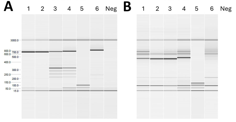 Genotyping study of Plasmodium falciparum isolated from 2 patients involved in nosocomial transmission of P. falciparum malaria, Spain, 2024. The genes analyzed were PfMSP-1 and PfMSP-2. Results for genotypes FC27 (A) and IC (B) for the MSP-2 families are shown. The findings indicate that the fragments detected in the index case are also present in the source case. MSP, merozoite surface protein; neg, negative.