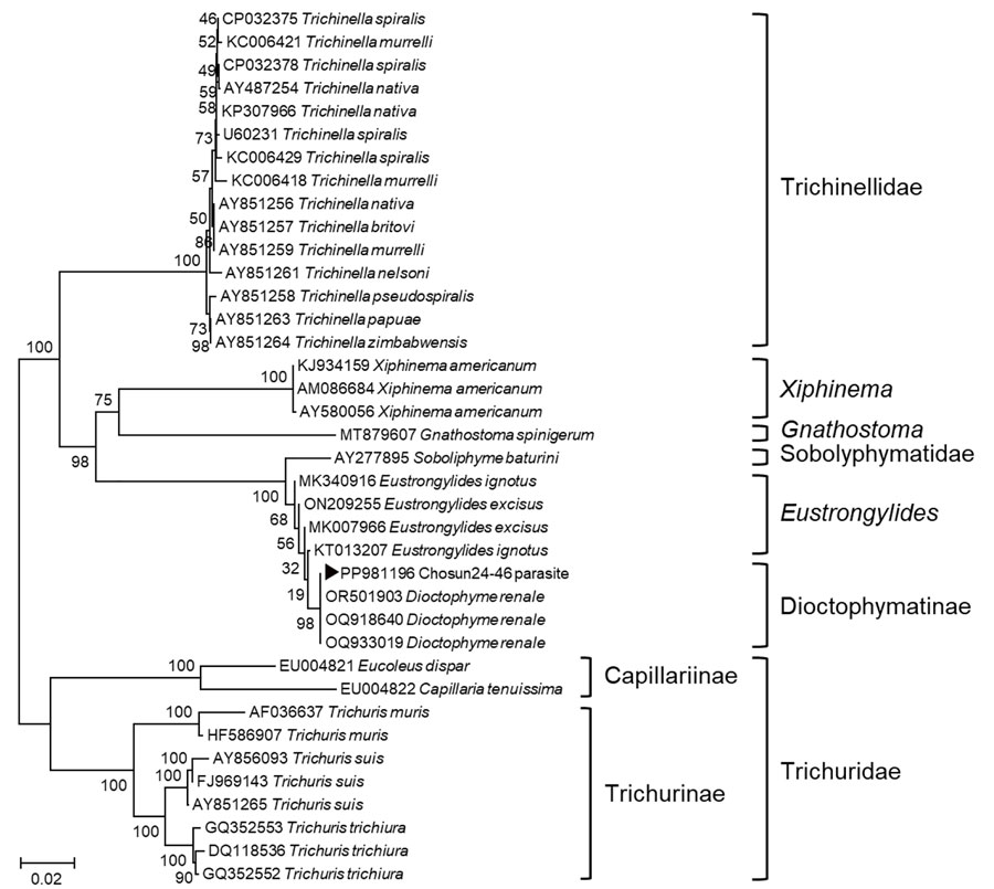 Phylogenetic tree for Dioctophyme renale roundworm showing a sequence from a patient with gastric submucosal tumor (black triangle), South Korea, 2024. Phylogenetic tree was based on the targeted 974-bp PCR amplicon sequence of D. renale from small subunit rRNA gene (18s RNA gene) sequences retrieved from GenBank (accession numbers shown). CLUSTAL X (http://www.clustal.org/clustal2) was used to construct phylogenetic tree by using neighbor-joining with 1,000 bootstrap replicates. We compared the D. renale sequence from our case with other roundworm sequences, and it aligned with 100% homology to D. renale. Scale bar indicates number of nucleotide substitutions per site.