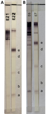 Equivocal results of cysticercosis Western blot IgG (LDBIO Diagnostics, https://ldbiodiagnostics.com) assay in study of subarachnoid neurocysticercosis caused by larval-stage Taenia crassiceps tapeworm, Slovenia. Results of patient’s serum (A) and cerebrospinal fluid (B) samples show 6–8 kDa band and a weak 12 kDa band. Cysticercosis-specific bands are 6–8 kDa (a), 12 kDa (b), 23–26 kDa (c), 39 kDa (d), and (50–55 kDa (e). The presence of >2 well-defined bands among the 5 mentioned is indicative of neurocysticercosis. E21, patient’s serum; E6, patient’s cerebrospinal fluid; E7 and E22, positive controls.