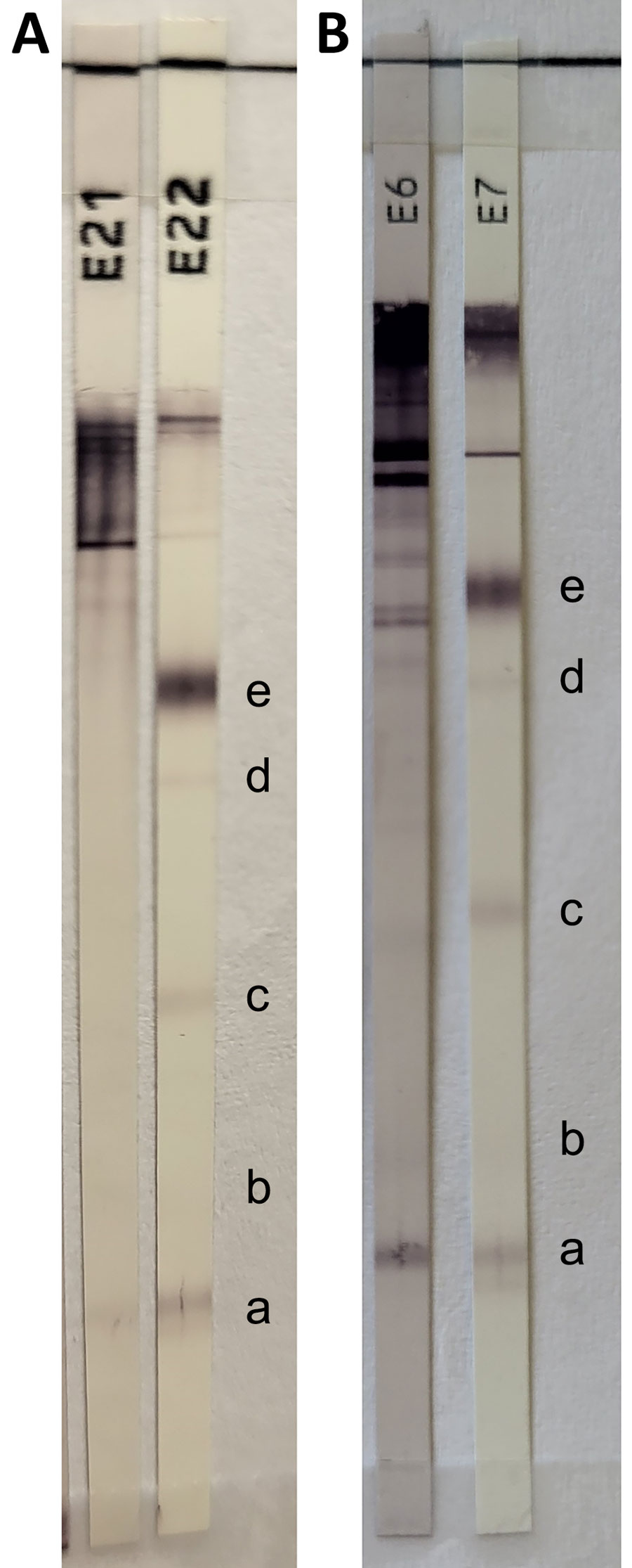 Equivocal results of cysticercosis Western blot IgG (LDBIO Diagnostics, https://ldbiodiagnostics.com) assay in study of subarachnoid neurocysticercosis caused by larval-stage Taenia crassiceps tapeworm, Slovenia. Results of patient’s serum (A) and cerebrospinal fluid (B) samples show 6–8 kDa band and a weak 12 kDa band. Cysticercosis-specific bands are 6–8 kDa (a), 12 kDa (b), 23–26 kDa (c), 39 kDa (d), and (50–55 kDa (e). The presence of >2 well-defined bands among the 5 mentioned is indicative of neurocysticercosis. E21, patient’s serum; E6, patient’s cerebrospinal fluid; E7 and E22, positive controls.