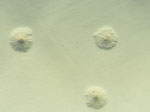 Stereomicroscopy of Mycoplasma arginini culture from the patient’s synovial fluid sample, showing small colonies with a characteristic fried egg appearance, with dense central core surrounded by a lighter peripheral zone. Original magnification ×40.