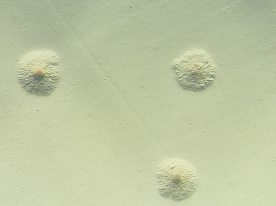Stereomicroscopy of Mycoplasma arginini culture from the patient’s synovial fluid sample, showing small colonies with a characteristic fried egg appearance, with dense central core surrounded by a lighter peripheral zone. Original magnification ×40.