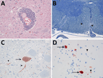 Evidence of persistent infection in 2 harbor seals stranded in the North Sea region years after phocine distemper virus epizootics. A) Marked perivascular accumulation of lymphocytes and plasma cells stained with hematoxylin and eosin from a seal infected in the 1988 epizootic outbreak (case 1). Original magnification ×. B) Vacuolation and demyelination (between arrowheads) in the cervical spinal cord in case 1, stained with Kluver luxol fast blue. Original magnification ×. C) Phocine distemper virus antigen expression in neuronal cell bodies (arrows) and axons or dendrites (arrowheads) of the spinal cord in case 1 by immunohistochemistry using monoclonal antibody against canine distemper virus. Original magnification ×. D) Phocine distemper virus antigen expression in neuronal cell bodies (arrows) and axons or dendrites (arrowheads) of the spinal cord of a seal infected in the 2002 epizootic outbreak (case 2) by immunohistochemistry using monoclonal antibody against canine distemper virus. Original magnification ×.